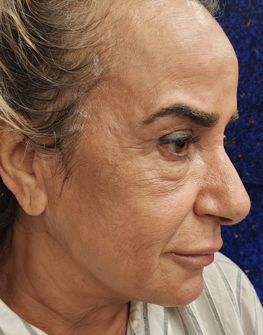 לקוחה, מבט מהצד, לפני הטיפול