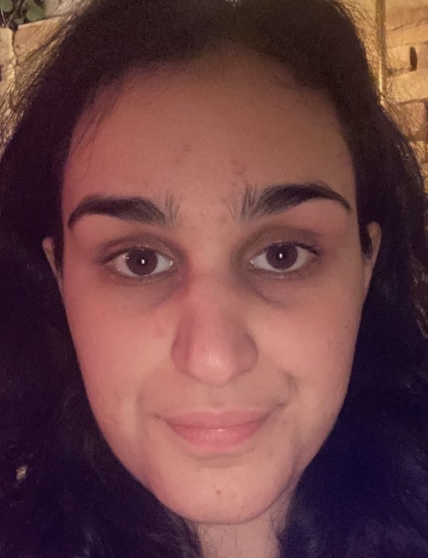 לקוחה שלישית, שבוע אחרי הטיפול